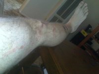 leg_scrapesa.JPG